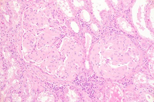 伝達性aaアミロイド症に関する研究 東京農工大学研究ポータル